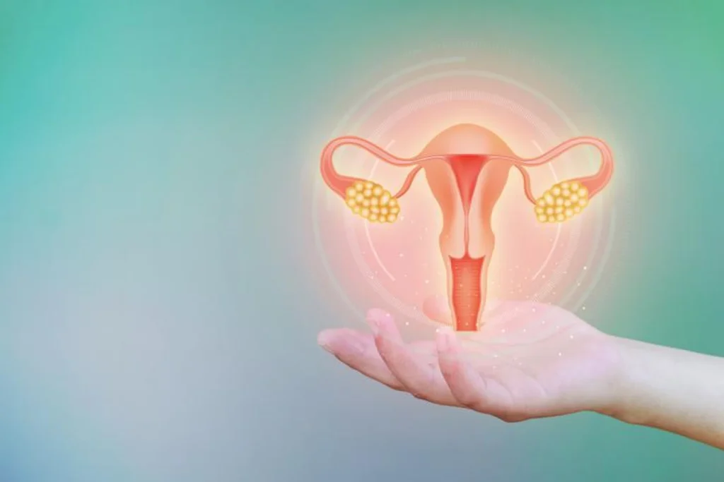 Managing PCOS: Expert Advice from an OB-GYN
